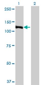 E4F1 Antibody in Western Blot (WB)