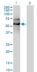 EBF1 Monoclonal Antibody (1C12)