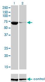 EBF1 Monoclonal Antibody (1G8)