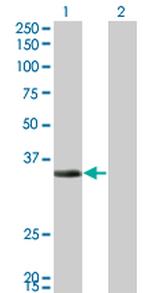 ECH1 Monoclonal Antibody (5G8)