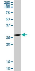 ECHS1 Antibody in Western Blot (WB)