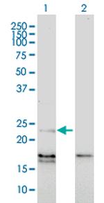 EDN1 Monoclonal Antibody (3D6)