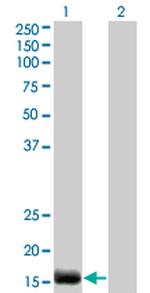 EDN2 Antibody in Western Blot (WB)