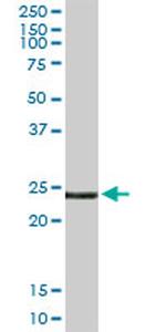 EDN3 Antibody in Western Blot (WB)