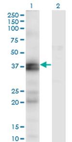EDNRA Monoclonal Antibody (2A5)