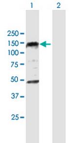 PHC1 Antibody in Western Blot (WB)