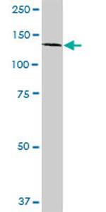 PHC1 Antibody in Western Blot (WB)