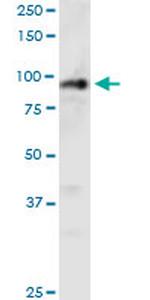 PHC1 Monoclonal Antibody (3G1)