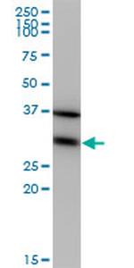 EEF1B2 Monoclonal Antibody (3A5)