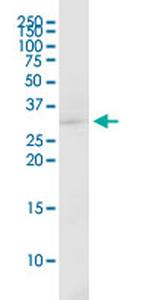 EEF1B2 Monoclonal Antibody (2G10)