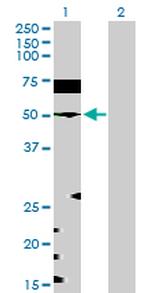 EEF1G Antibody in Western Blot (WB)