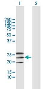 EFNA2 Polyclonal Antibody, MaxPab™