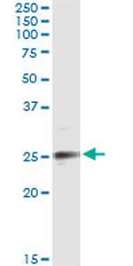 EFNA3 Monoclonal Antibody (2H3)