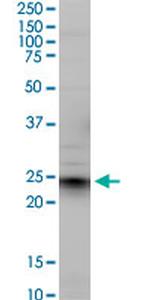 EFNA5 Monoclonal Antibody (1F12)