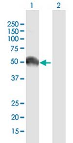 EGFR Antibody in Western Blot (WB)
