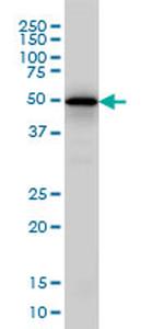 EGR1 Monoclonal Antibody (3G3)