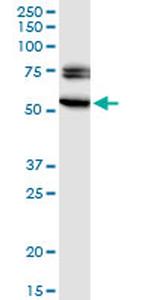 EGR2 Monoclonal Antibody (1G5)