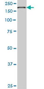 EIF4G1 Monoclonal Antibody (3A10)