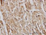EIF4G2 Monoclonal Antibody (3B5)