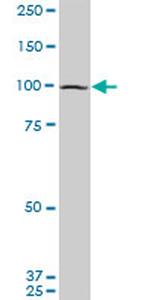 EIF4G2 Antibody in Western Blot (WB)