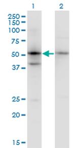 SERPINB1 Antibody in Western Blot (WB)