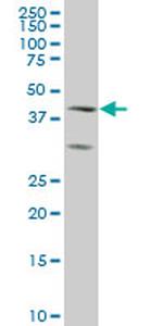 ELF3 Monoclonal Antibody (1D8)