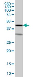 ELF3 Monoclonal Antibody (2B11)