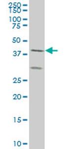 ELF3 Monoclonal Antibody (3B6)
