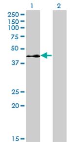 ELK3 Monoclonal Antibody (3A12)