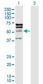 ELK4 Polyclonal Antibody, MaxPab™