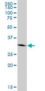 EMD Antibody in Western Blot (WB)