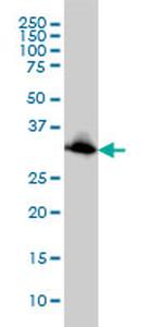 EMD Antibody in Western Blot (WB)