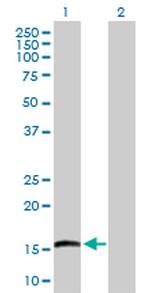 EMP3 Antibody in Western Blot (WB)