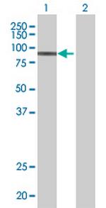 ENG Antibody in Western Blot (WB)