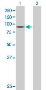 ENG Antibody in Western Blot (WB)