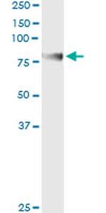 ENG Antibody in Immunoprecipitation (IP)