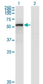 ENG Antibody in Western Blot (WB)