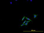 ENG Antibody in Immunocytochemistry (ICC/IF)