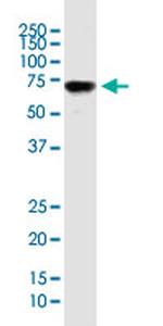 ENG Antibody in Western Blot (WB)