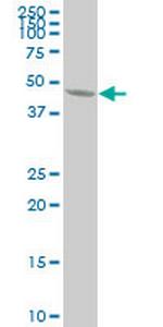 ENO1 Monoclonal Antibody (1G1)