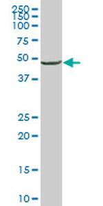 ENO1 Monoclonal Antibody (5F4)