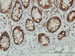 ENO3 Antibody in Immunohistochemistry (Paraffin) (IHC (P))