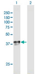 SLC29A1 Polyclonal Antibody, MaxPab™