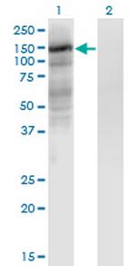 EPAS1 Monoclonal Antibody (1G2)