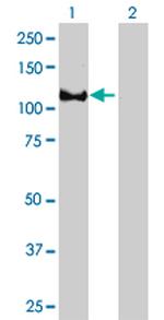 EPB41 Antibody in Western Blot (WB)