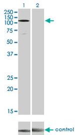 EPHA3 Monoclonal Antibody (3A12)