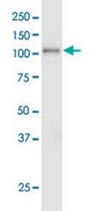 EPHA3 Antibody in Western Blot (WB)