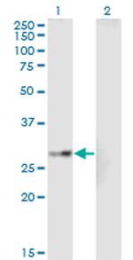 EPHA7 Antibody in Western Blot (WB)
