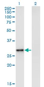 EPHA7 Antibody in Western Blot (WB)