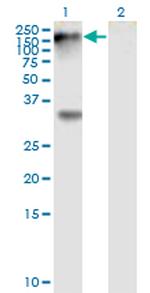 EPHB1 Monoclonal Antibody (4G6)